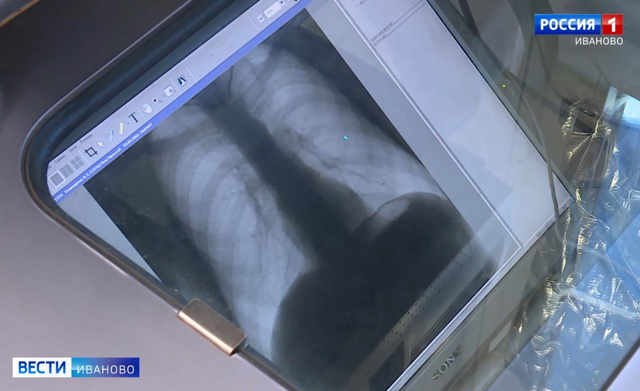 В Иванове пройдут тематические мероприятия ко Всемирному дню борьбы с туберкулезом